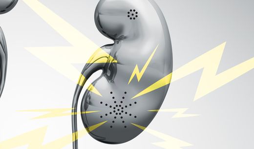 Illustration of a kidney and a phone.