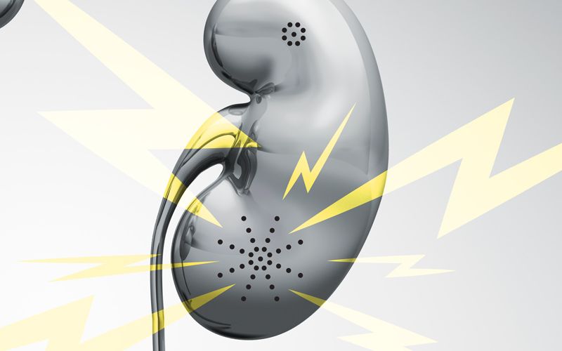 Illustration of a kidney and a phone.